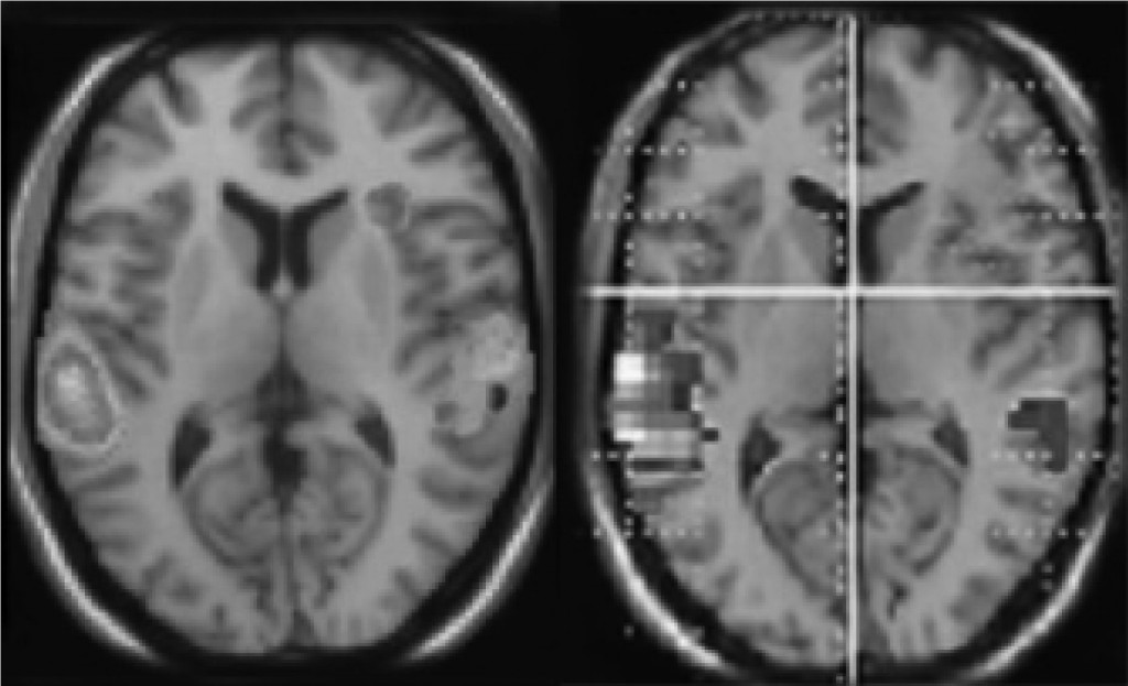 fulllength-fMRI-2