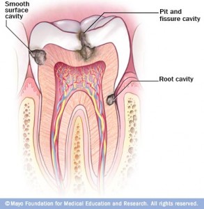 features-teeth-1