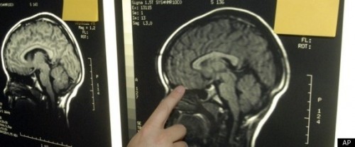 Brain2