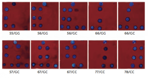 Rapid determination of MIF allele in areas without genomic analysis capabilities is now available through the use of biochips, which measure only 1cm in length. Pictured above are biochips showing every combination of MIF allele (5, 6, 7 or 8 short DNA repeats) and a single nucleotide polymorphism. Courtesy of Dr. Bucala.