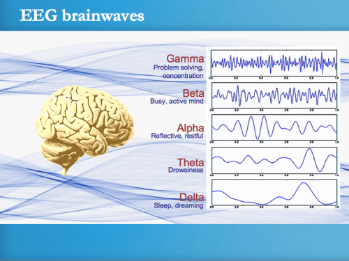 Electroencephalograms (EEGs) can record waves of different frequencies, including alpha waves and gamma waves. A spike in gamma wave activity was measured in the rats’ brains immediately after cardiac arrest. Photo courtesy of Transcendental Meditation.