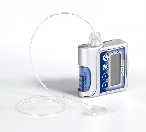 An insulin pump can be used to deliver insulin without multiple injections. Courtesy of Biotuesdays.