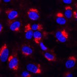Light microscopy image showing viruses (stained red) accumulating inside the endocytic compartments of host cells (with their nuclei stained blue). Courtesy of Yorgo Modis.