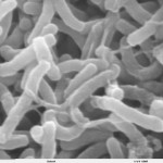 An electron micrograph of Vibrio cholerae, the bacterium responsible for cholera. The virulence of V. cholerae and other bacteria like it relies upon small molecules targeting specific host processes. Photo courtesy of the Dartmouth Rippel Electron Microscope Facility.  