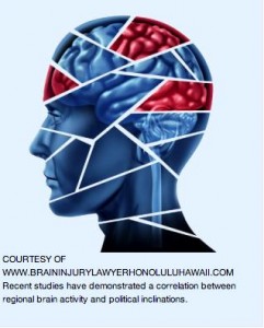 3.Recent studies have claimed a correlation between regional brain activity and political inclinations. Image courtesy of Brain Injury Lawyer Honolulu Hawaii.