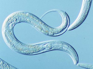 C. elegans was the model organism used in this study. This figure highlights the transparent nature of the worm and shows axons spanning the body of the organism. Courtesy of Alexandra Byrne. 