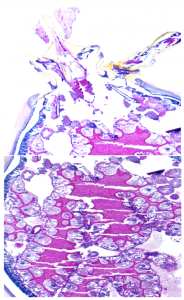 Here is a nymphal tick, having been fed for 72 hours, and its gut diverticula. The epithelial cells are lined with the peritrophic membrane (PM), which is pink, due to PAS staining. The image has been magnified ten times. Courtesy of Dr. Sukanya Narasimhan, Yale University Department of Internal Medicine.