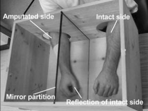 The mirror box treatment creates the illusion that the patient has two intact arms. Image courtesy of BBC News.