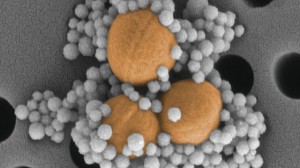 MBL-coated magnetic nanoparticles bonded to S. aureus bacteria. Graphic courtesy of Harvard’s Wyss Institute.