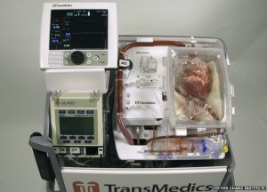The image above is the heart-in-a-box machine that has the potential to reestablish a beat in hearts post-circulatory death. 