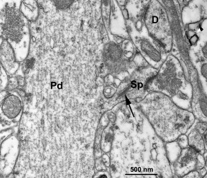 An electron micrograph shows an asymmetric, excitatory synapse on the spine of a pyramidal cell’s dendrite in the hippocampus. Spines are protrusions from a neuron’s dendrite, which typically receive input from one excitatory synapse. Image courtesy of John Elsworth.