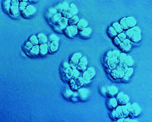 Methanosarcina acetivorans, a microbe in the kingdom Archaea, is one of only a few organisms to encode pyrrolysine. Image courtesy of the Broad Institute.