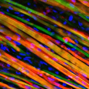 This is an image of muscle fibers that have been grown in a lab and then implanted into a mouse. The fibers have been stained to observe growth. Image courtesy of Duke University. 