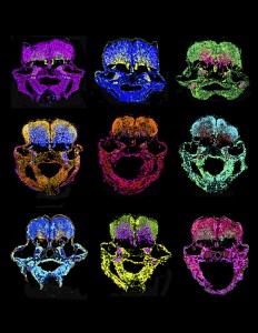 Hindbrain cross-sections show zebrafish embryos at 48 and 60 hours post fertilization. The absence of miR-107 promotes neurogenesis. Image courtesy of Emma Ristori. 