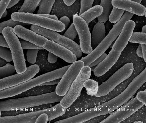 Escherichia coli is a rod-shaped bacterium; certain strains are associated with food-borne illness. Image courtesy of Wikimedia Commons.