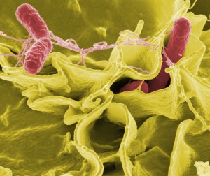Salmonella Typhimurium has a similar structure and appearance to Salmonella Newport, which caused illnesses at Chipotle restaurants in Minnesota. Image courtesy of Wikimedia Commons.