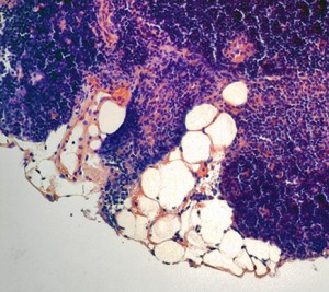 As we age, our thymus becomes packed with fat cells, which compromises the organ’s function. Image courtesy of Vishwa Dixit