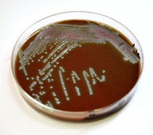 Potentially contaminated water is currently tested by using a petri dish like the one pictured above. Fluid-Screen will potentially make this practice obsolete. Image courtesy of public_image_domain.com