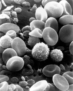 Human blood contains, among other things, red blood cells, white blood cells, and platelets. Platelets appear small and disc-shaped. Image Courtesy of Wikimedia Commons.