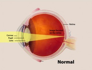 The convex lens of the eye focuses light onto the back of the eye, at the retina. Cyanobacteria work similarly to detect light sources. Image courtesy of National Eye Institute, National Institutes of Health.     