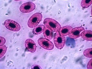 The Random Forest model developed by Taylor and his team can predict the risk of sepsis, commonly called blood poisoning. These are unaffected, healthy red blood cells.