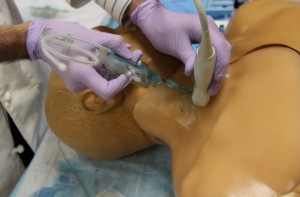 Physicians use their thumbs to steer the guide-wire into the patient’s vein. The Ballistra one-handed system greatly improves accuracy. Images courtesy of Brandon Hudik and Andres Ornelas Vargas.