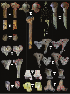 Many of Lucy’s bones showed evidences of compressive fractures, outlined in red. Image courtesy of John Kappelman