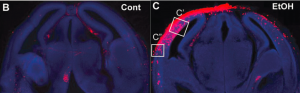 Cellular damage was imaged using the fluorescent reporter system in control mice (left) and mice exposed to alcohol during prenatal development (right). Damaged cells are shown by the red fluorescence.